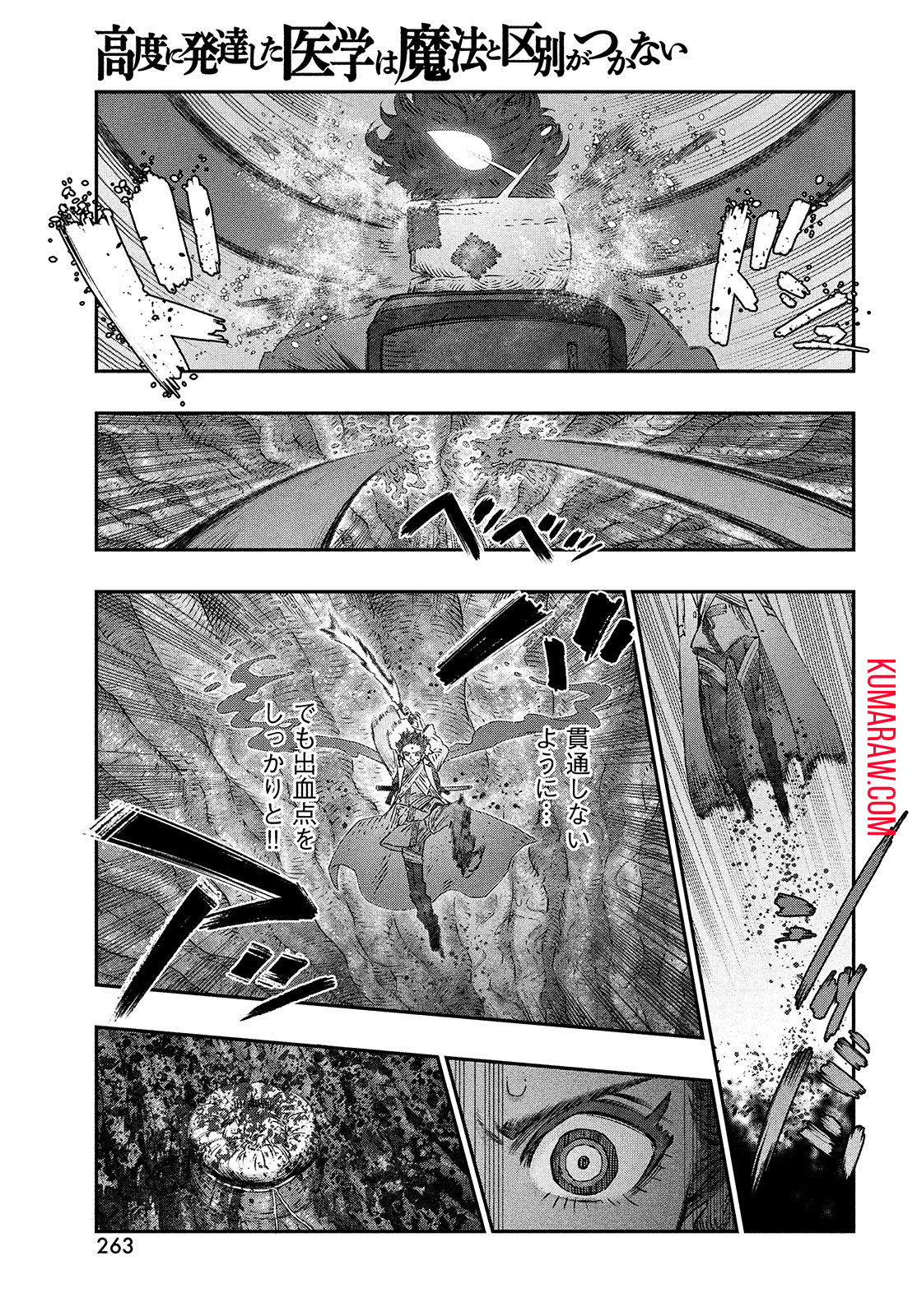 高度に発達した医学は魔法と区別がつかない 第9話 - Page 23