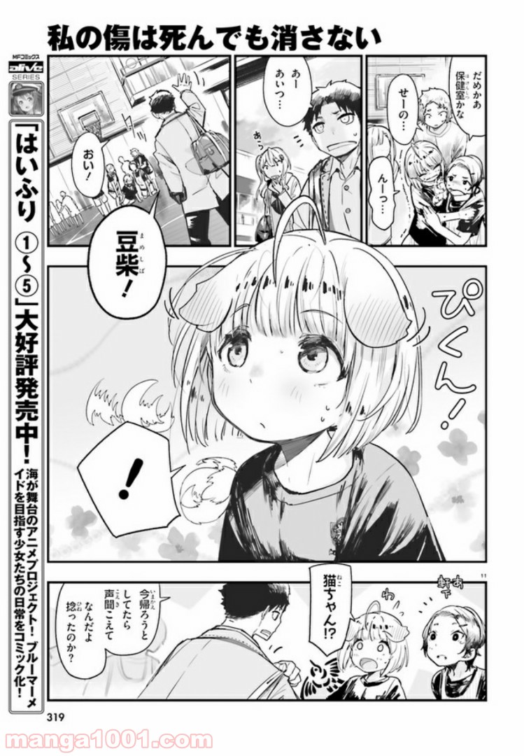私の傷は死んでも消さない 第4.1話 - Trang 11