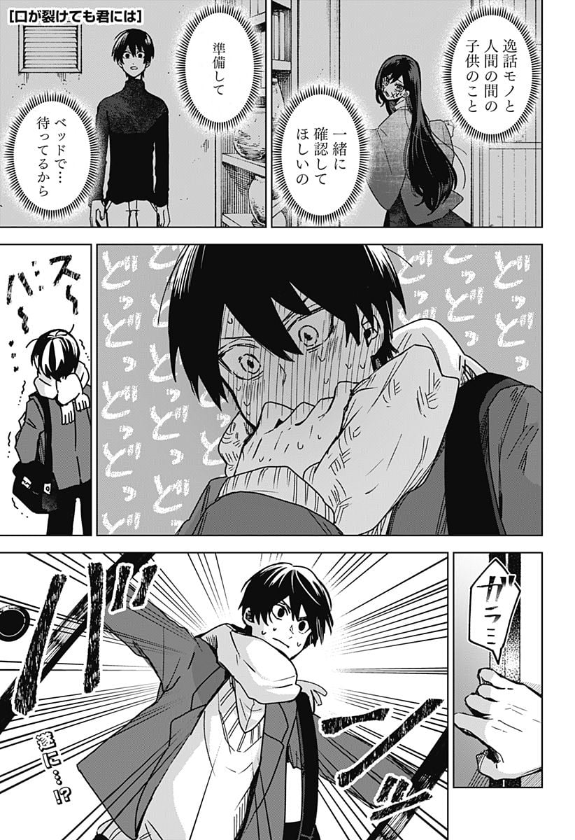 口が裂けても君には - 第70話 - Page 1